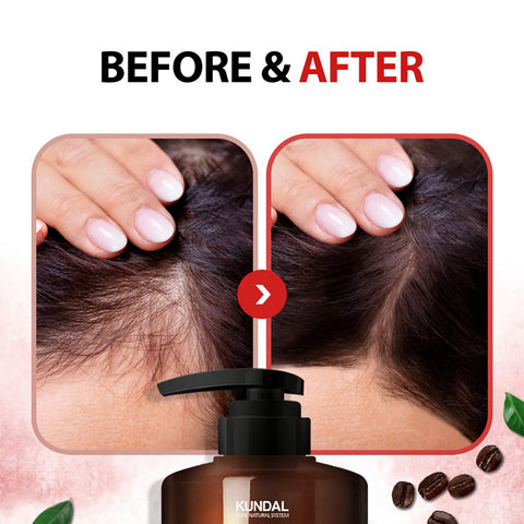 Kundal Caffeine Scalp Care Shampoo Cherry Blossom hiustenkasvu ennen ja jälkeen