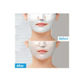 MediAnswer Pore Collagen Mask naamio ennen ja jälkeen