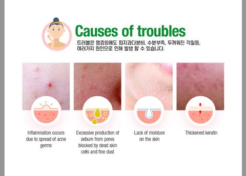 [Acropass] Trouble Cure Pimple Patch