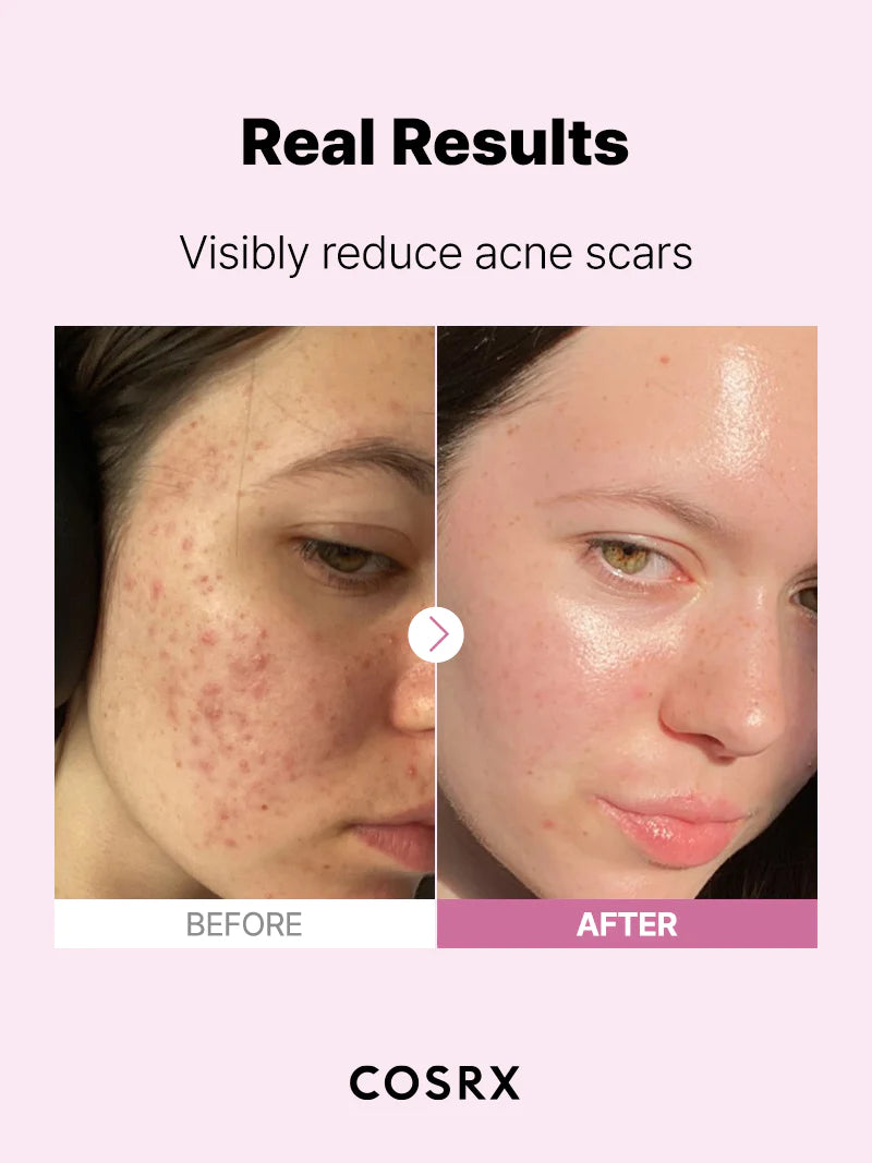 [COSRX] Das Niacinamide 15 Serum